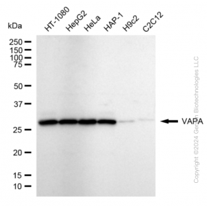 KD-Validated VAPA Rabbit mAb (20 μl)