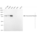 KD-Validated NR3C1 Mouse mAb (20 μl)