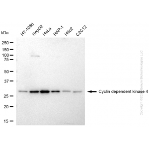 KD-Validated CDK2 Mouse mAb (20 μl)