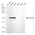 KD-Validated KRT7 Rabbit mAb (20 μl)
