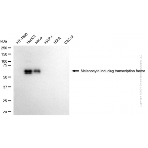 KD-Validated MITF Mouse mAb (20 μl)