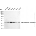KD-Validated SOD2 Mouse mAb (20 μl)