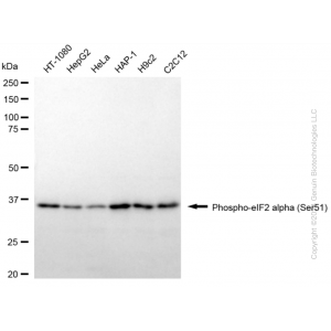 KD-Validated Phospho-EIF2S1 (Ser51) Rabbit mAb (20 μl)