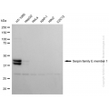 KD-Validated SERPINE1 Rabbit mAb (20 μl)