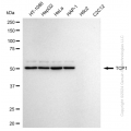 KD-Validated TCP1 Rabbit mAb (20 μl)