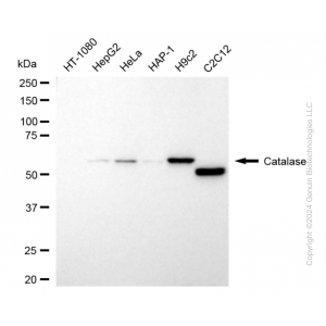 KD-Validated CAT Rabbit mAb (20 μl)