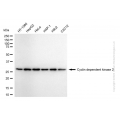 KD-Validated CDK2 Rabbit mAb (20 μl)