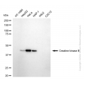 KD-Validated CKB type Rabbit mAb (20 μl)