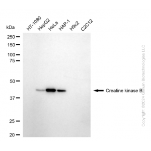KD-Validated CKB type Rabbit mAb (20 μl)