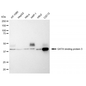 KD-Validated GATA3 Rabbit mAb (20 μl)