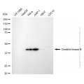 KD-Validated CKB type Rabbit mAb (20 μl)