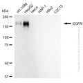 KD-Validated EGFR Rabbit mAb (20 μl)