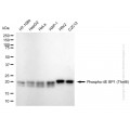 KD-Validated Phospho-EIF4EBP1 (Thr46) Rabbit mAb (20 μl)