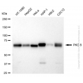 KD-Validated PRKCD Rabbit mAb (20 μl)