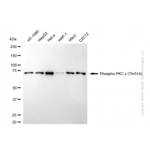 KD-Validated Phospho-PRKCG (Thr514) Rabbit mAb (20 μl)