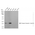 KD-Validated Phospho-PSEN1 (Ser310) Rabbit mAb (20 μl)
