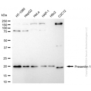 KD-Validated PSEN1 Rabbit mAb (20 μl)