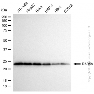 KD-Validated RAB5A Rabbit mAb (20 μl)