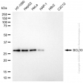 KD-Validated BCL10 Rabbit mAb (20 μl)