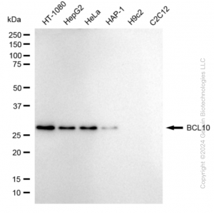 KD-Validated BCL10 Rabbit mAb (20 μl)