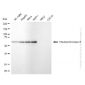 KD-Validated CHEK2 Rabbit mAb (20 μl)