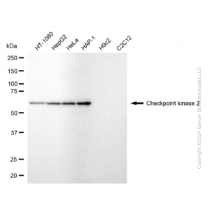 KD-Validated CHEK2 Rabbit mAb (20 μl)