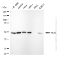 KD-Validated MLKL Rabbit mAb (20 μl)