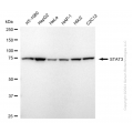 KD-Validated STAT3 Rabbit mAb (20 μl)