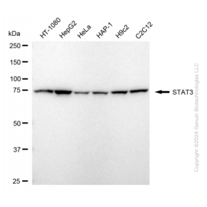 KD-Validated STAT3 Rabbit mAb (20 μl)