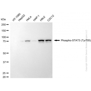 KD-Validated Phospho-STAT3 (Tyr705) Rabbit mAb (20 μl)