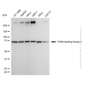 KD-Validated TBK1 Rabbit mAb (20 μl)