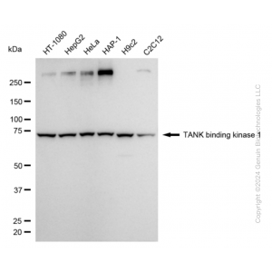 KD-Validated TBK1 Rabbit mAb (20 μl)