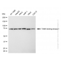 KD-Validated TBK1 Rabbit mAb (20 μl)