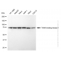 KD-Validated TBK1 Rabbit mAb (20 μl)