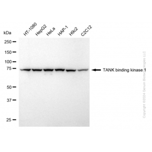 KD-Validated TBK1 Rabbit mAb (20 μl)