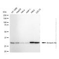 KD-Validated ANXA4 Rabbit mAb (20 μl)
