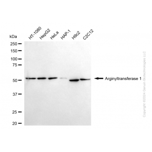KD-Validated ATE1 Rabbit mAb (20 μl)