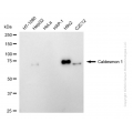 KD-Validated CALD1 Rabbit mAb (20 μl)