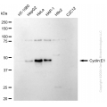 KD-Validated CCNE1 Rabbit mAb (20 μl)