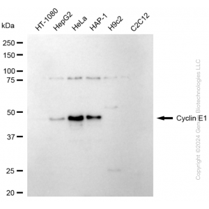 KD-Validated CCNE1 Rabbit mAb (20 μl)