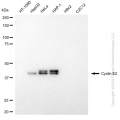 KD-Validated CCNE2 Rabbit mAb (20 μl)