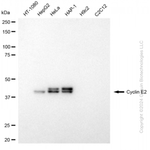 KD-Validated CCNE2 Rabbit mAb (20 μl)