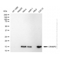KD-Validated CRABP2 Rabbit mAb (20 μl)
