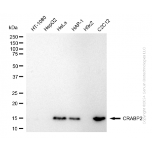KD-Validated CRABP2 Rabbit mAb (20 μl)