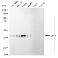 KD-Validated DFFA Rabbit mAb (20 μl)