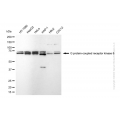 KD-Validated GRK6 Rabbit mAb (20 μl)