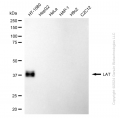 KD-Validated LAT Rabbit mAb (20 μl)