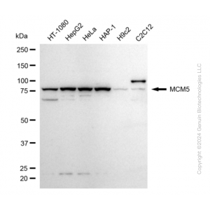 KD-Validated MCM5 Rabbit mAb (20 μl)