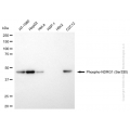 KD-Validated Phospho-NDRG1 (Ser330) Rabbit mAb (20 μl)