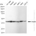 KD-Validated PAWR Rabbit mAb (20 μl)